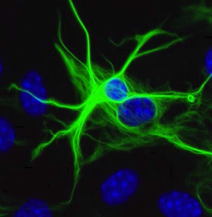 Alzheimer - Images d’astrocytes en épifluorescence
